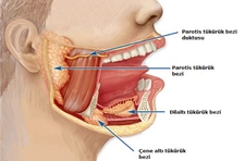 Kulak Altı Tükürük Bezi Şişmesi Belirtileri ve Tedavisi
