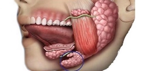 Tükürük Bezi İltihabı Bulaşıcı mıdır?